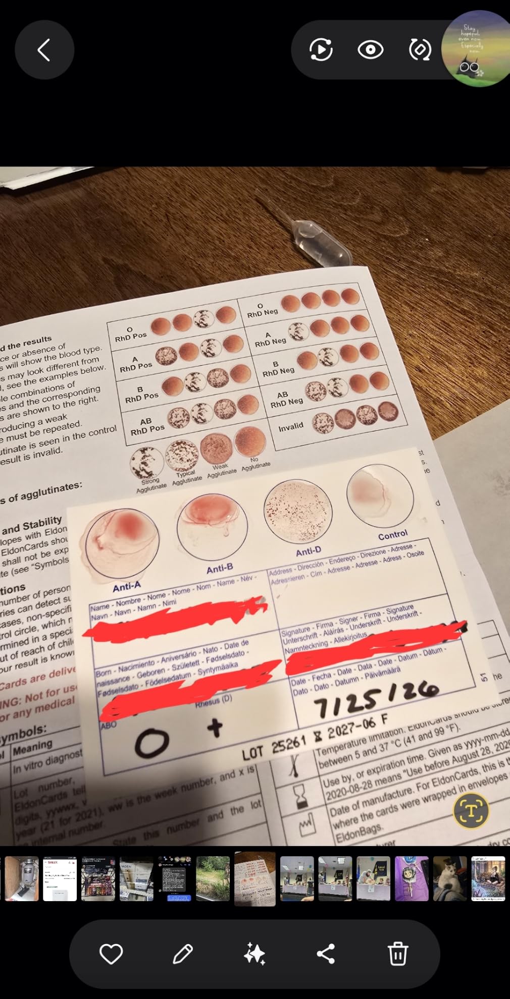 Eldoncard INC Blood Type Test, 1 Pack | Complete Kit, A, B, O, AB & RH Results, Results in Minutes, Includes Safety Lancet, Micropipette, Cleansing Swab customer photo 1