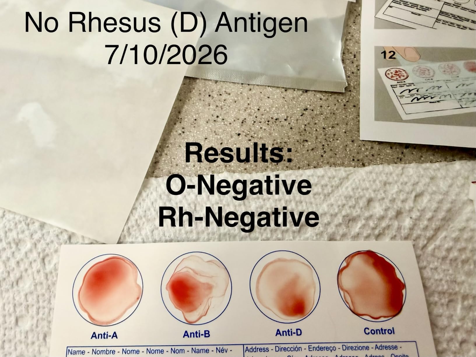 Eldoncard INC Blood Type Test, 1 Pack | Complete Kit, A, B, O, AB & RH Results, Results in Minutes, Includes Safety Lancet, Micropipette, Cleansing Swab customer photo 2