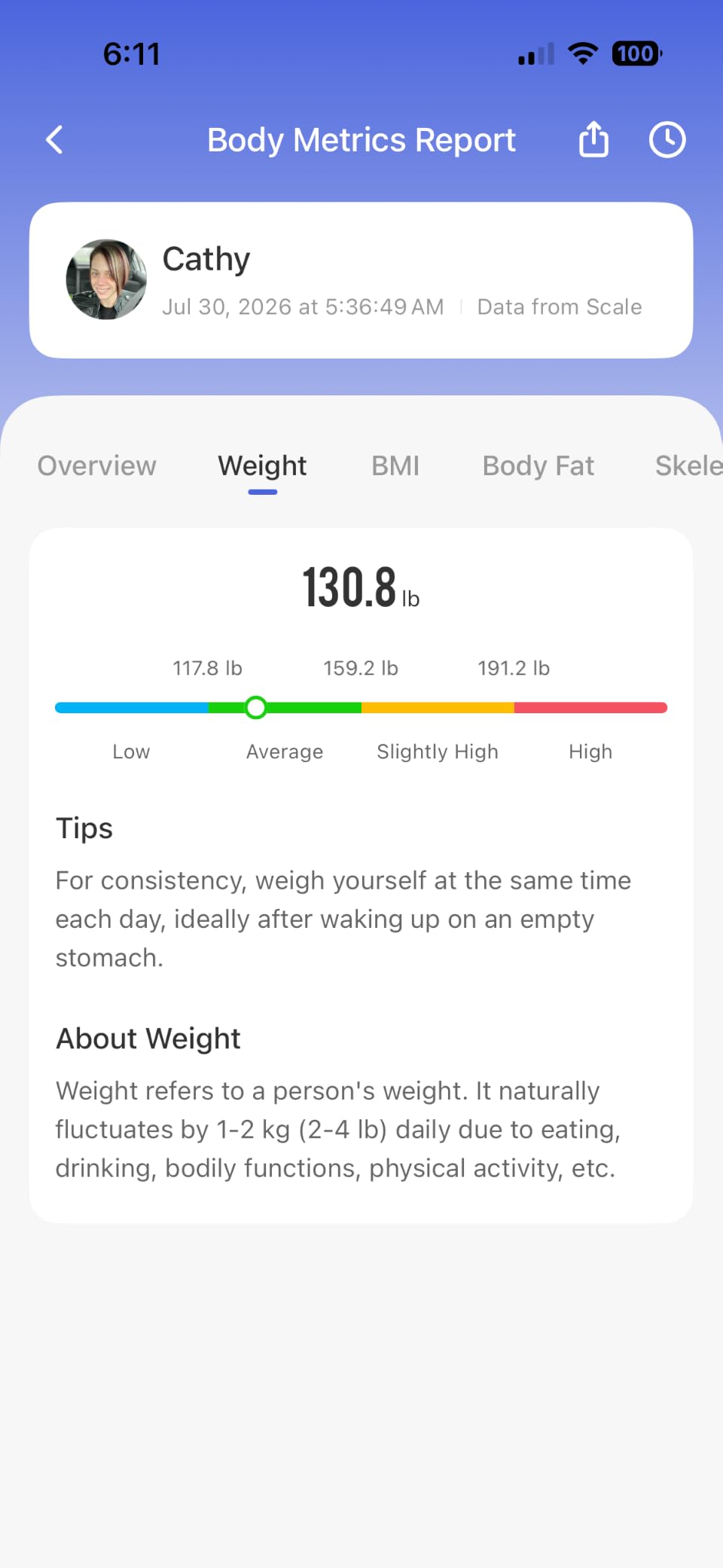 RENPHO Smart Scale for Body Weight, TFT Handle Display, Rechargeable | 8-Electrode Scale, Voice Broadcast, 50+ Metrics, Body Composition Scale with Muscle Mass, FSA Eligible HSA, MorphoScan Nova customer photo 1