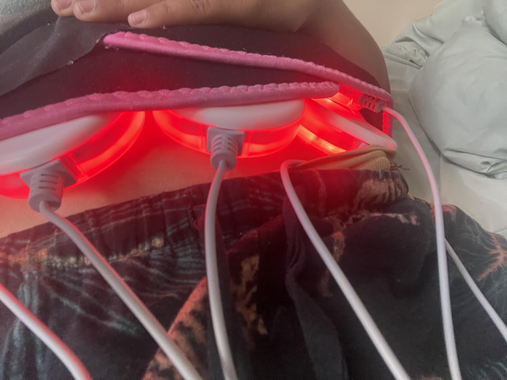 LIPO-Light Machine Body Shaper Weight Loss Fat Reduction Burning Fat Remove Fat Dissolve Beauty Machine customer photo 2