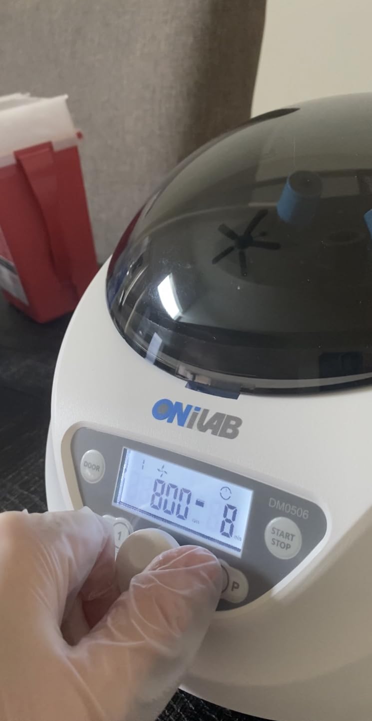 ONiLAB PRP Centrifuge, 8X15ml/10ml/7ml/1.5-5ml, 300-4000RPM, Max 1860×g customer photo 1
