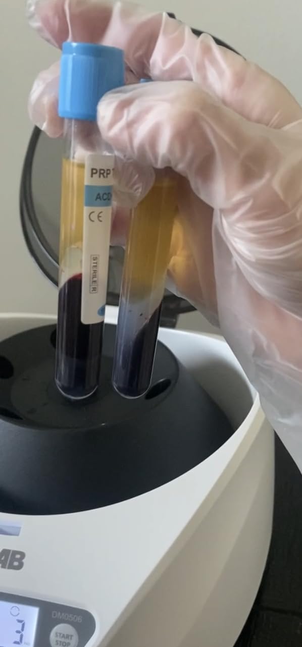 ONiLAB PRP Centrifuge, 8X15ml/10ml/7ml/1.5-5ml, 300-4000RPM, Max 1860×g customer photo 2